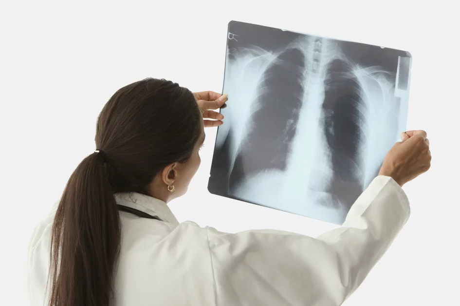 Изображение 1 для Войдет ли пневмония в статистику по COVID-19, рассказала вице-министр здравоохранения