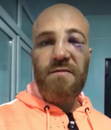 Изображение 1 для Защитник прав трансгендеров избит на митинге в Алматы