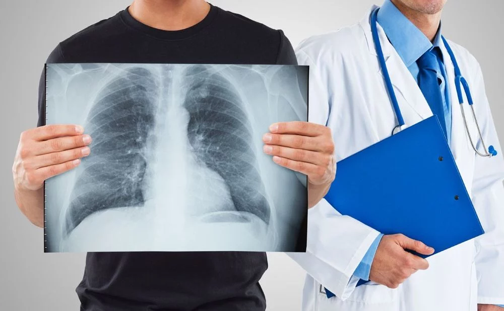 Изображение 1 для В Казахстане стали реже болеть туберкулезом