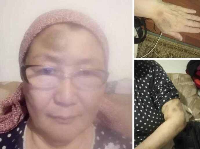 Изображение 1 для Омбудсмен отреагировала на грубое задержание активистки