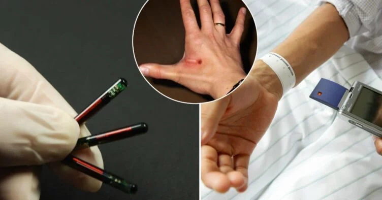 Илон Маск 2022 жылдан бастап адамға чип орнататынын айтты - изображение 1