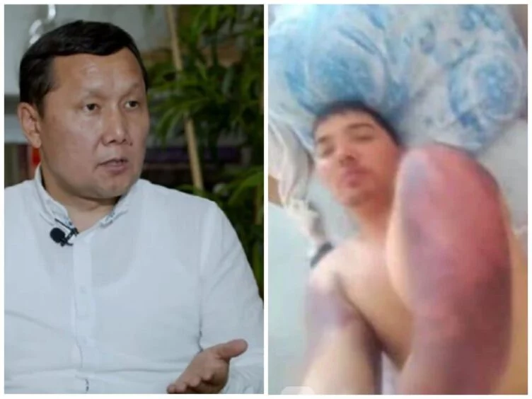 Изображение 1 для Белгілі заңгер Батырбаевты үтік басып қинағандары рас екенін айтты