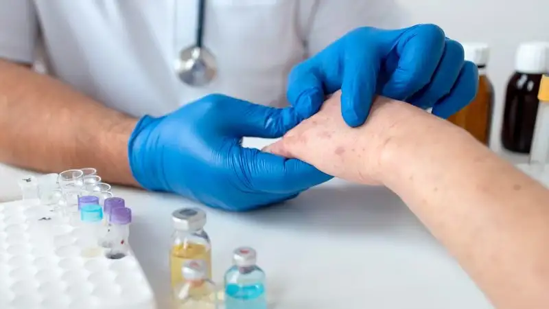 Изображение 1 для Казахстан вошел в тройку мировых лидеров по заболеваемостью корью