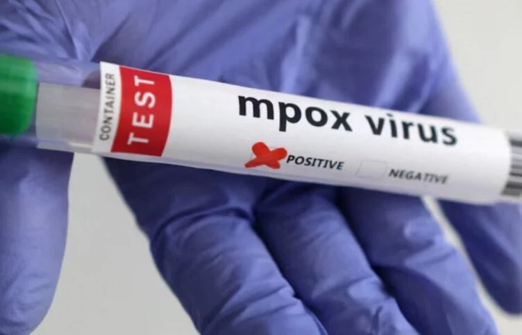 Минздрав потратил более 900 тыс. тенге на закуп отечественных реагентов для выявления вируса Mpox - изображение 1