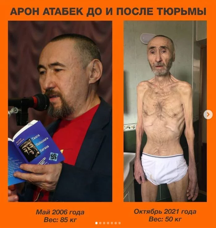 Дочь Арона Атабека опубликовала фото исхудавшего отца - изображение 1