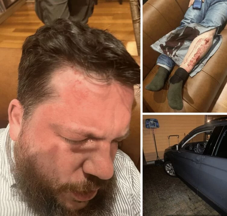 На соратника Навального Леонида Волкова совершили нападение возле его дома - изображение 1