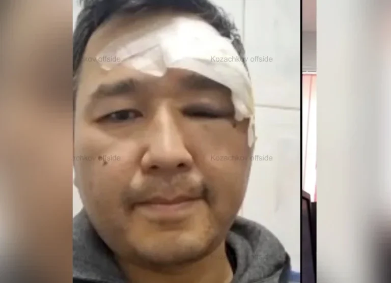 Гендиректора КазТАГ Асета Матаева арестовали на два месяца по делу о драке - изображение 1